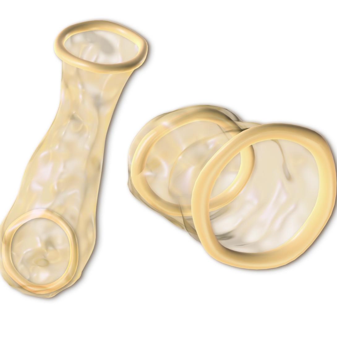 Internal Condom University Health Service   Female Condom 